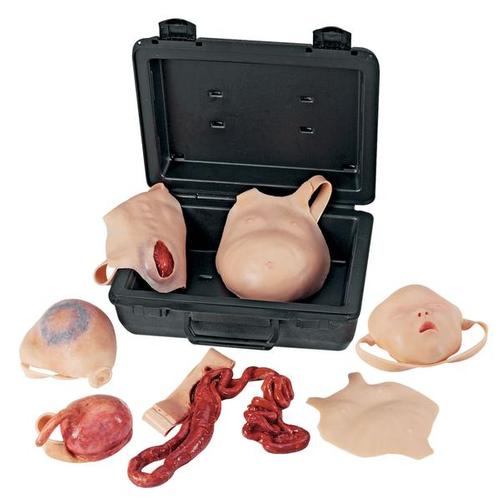 Neonatal Wound Kit - Nasco