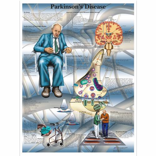 Parkinson's Disease Chart - 3B