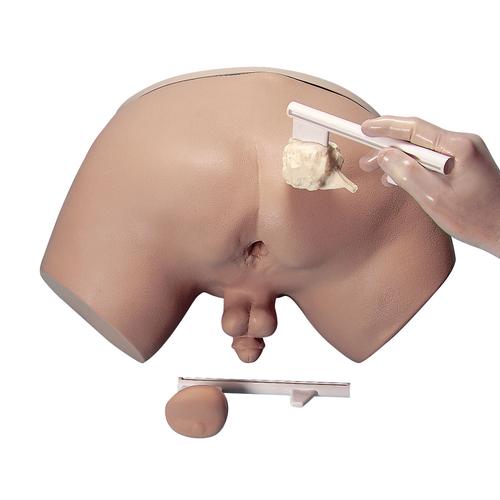 Prostate Examination Simulator. - Nasco