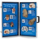 Consequences of Drug Abuse, 3D Info Board