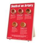 Death of An Artery Easel Display
