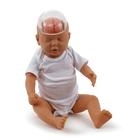 Shaken Baby Demonstration Model