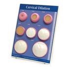 Cervical Dilation Easel Display