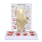 Meniscus Knee Model with 6 Tears