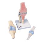 Knee Joint Model, 3 part - Sectional