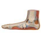 Flat Foot (Pes Planus)