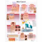 Skin Cancer Chart