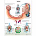 Cancer Chart