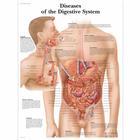 Diseases of the Digestive System Chart