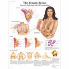 The Female Breast Chart - Anatomy, Pathology and Self-Examination
