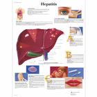 Hepatitis Chart