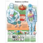 Diabetes Mellitus Chart