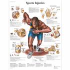 Sports Injuries Chart