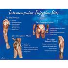 Intramuscular Injection Sites Poster