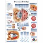 Diseases of the Eye Chart