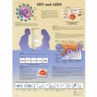 HIV and AIDS Chart