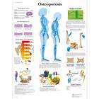 Osteoporosis Chart