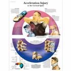 Acceleration Injury to the Cervical Spine Chart