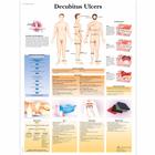 Decubitus Ulcers Chart