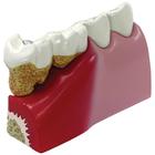 Teeth Model