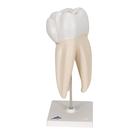 Upper Triple-Root Molar Human Tooth Model, 3 part