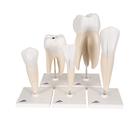 Tooth Model Series, 5 models