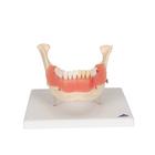 Dental Disease Model, Magnified 2 times, 21 parts