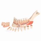 Advanced Half Lower Jaw with 8 diseased teeth, 19 part