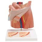 Inguinal Hernia Urology Model