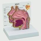 Sinus cross section