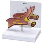 Artery Model