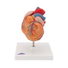 Human Heart Model with Left Ventricular Hypertrophy (LVH), 2 part
