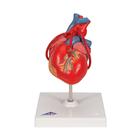 Human Heart Model with Bypass, 2 part