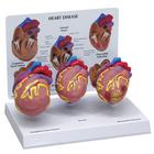 Heart Mini Model Set of 3