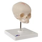 Foetal Skull Model, Natural Cast, 30th week of Pregnancy, on Stand