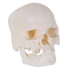 Microcephalic Human Skull Model