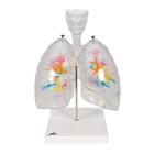 CT Bronchial Tree with Larynx and Transparent Lungs