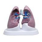 Lung Set with Pathologies