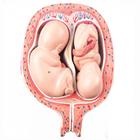 5th Month Twin Fetuses - Normal Position