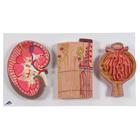 Kidney Section, Nephrons, Blood Vessels and Renal Corpuscle
