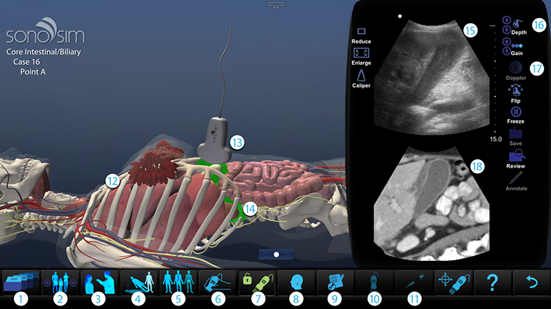 5) SonoSimulator Features