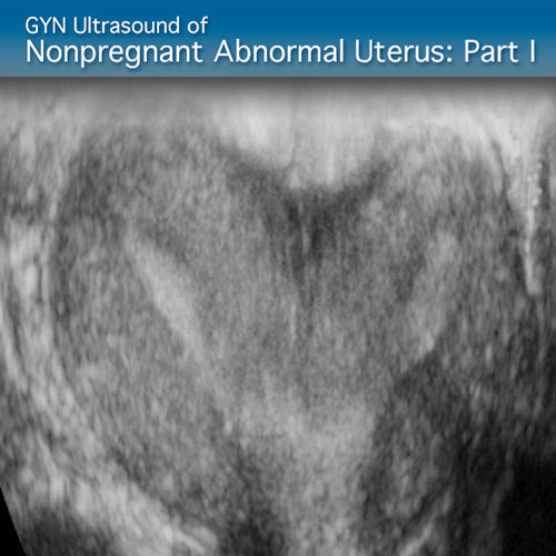 Advanced Clinical Module: GYN Ultrasound of Nonpregnant Abnormal Uterus Part I