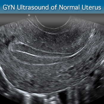 Advanced Clinical Module: GYN Ultrasound of Nonpregnant Normal Uterus