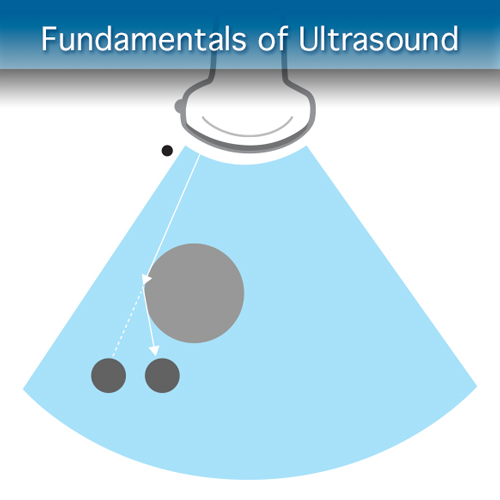 Core Clinical Module: Fundementals of Ultrasound