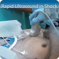 Core Clinical Module: Rapid Ultrasound in Shock Module