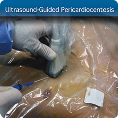 Procedure Module: Ultrasound-Guided Pericardiocentesis