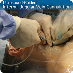 Procedure Module: Ultrasound-Guided Internal Jugular Vein Cannulation