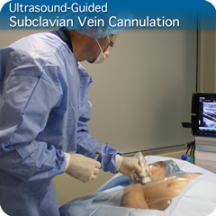 Procedure Module: Ultrasound-Guided Subclavian Vein Cannulation