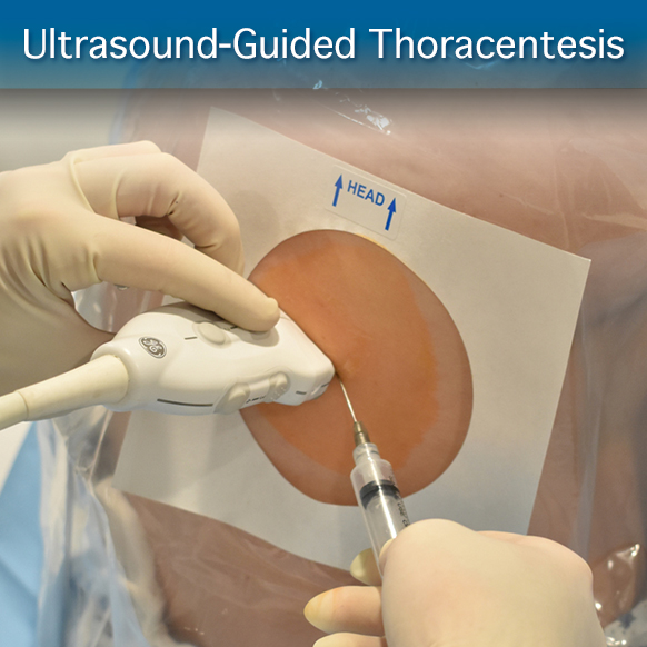 Procedure Module: Ultrasound-Guided Thoracentesis