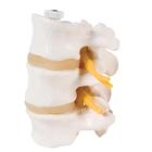 3 Lumbar Vertebrae, flexibly mounted